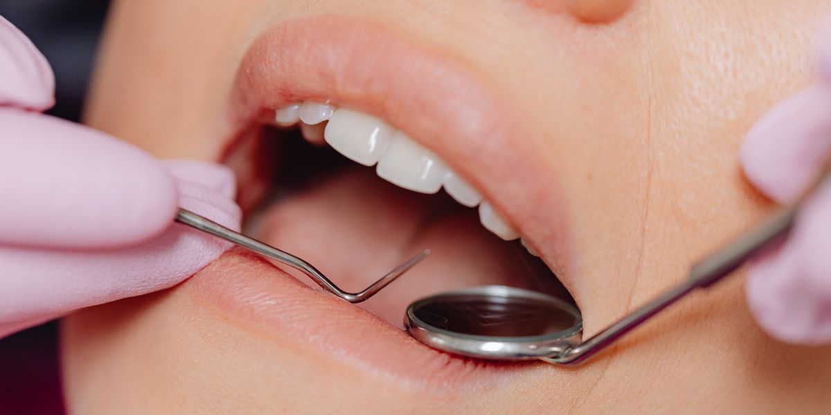 Why General Dental Care Is Essential for a Healthy Smile and Long-Term Oral Wellness